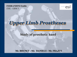 Upper Limbs Prostheses