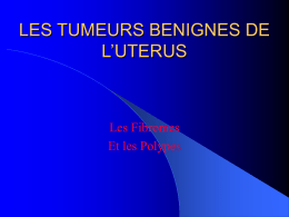 LES TUMEURS BENIGNES DE L UTERUS