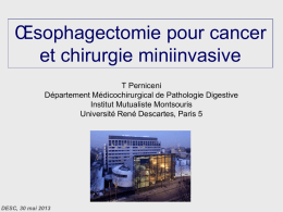 Oesophagectomie pour cancer : abord mini invasif
