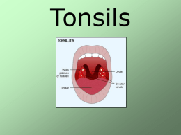 Tonsils - ent lectures