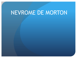 NEVROME DE MORTON