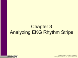 Chapter 3 Analyzing EKG Rhythm Strips