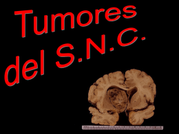 8. Tumores del S.N.C