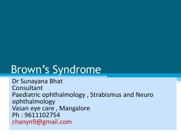 Brown`s Syndrome - MM Joshi Eye Institute