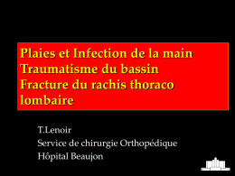 Traumatisme bassin-thorax