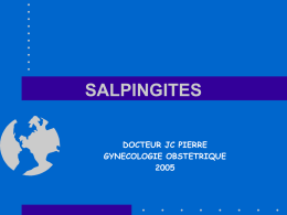SALPINGITES - E