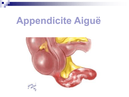 Appendicite (2355 Ko)
