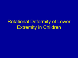 Rotational Deformity of Lower Extremity in Children