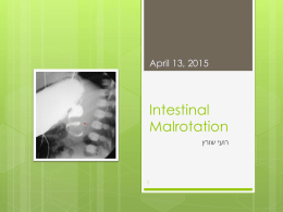 Intestinal Malrotation