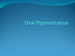 Oral Pigmentation-2