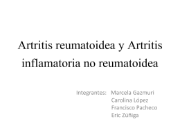 Artritis reumatoidea y Artritis inflamatoria no reumatoidea