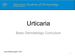 Urticaria - American Academy of Dermatology