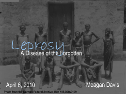 Leprosy