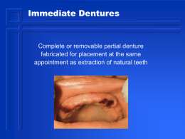 21. Immediate Denture - Removable Prosthodontics