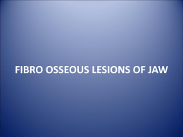 FIBRO OSSEOUS LESIONS OF JAW