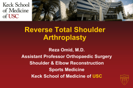 Reverse Total Shoulder Arthroplasty