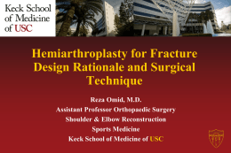 Integra Talk - Hemiarthroplasty for Fracture