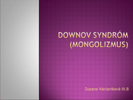 Downov syndróm (Mongolizmus)