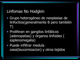 Linfomas No Hodgkin