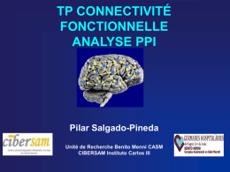 TP_PPI - Centre IRM Fonctionnelle