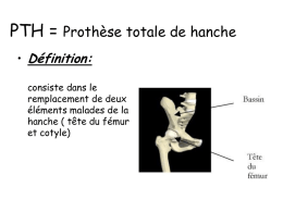 PTH= Prothèse totale de hanche