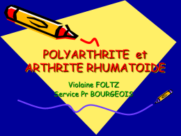 POLYARTHRITE et ARTHRITE RHUMATOIDE