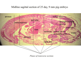 Pig embryo - transverse sections