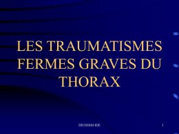 LES TRAUMATISMES FERMES GRAVES DU THORAX