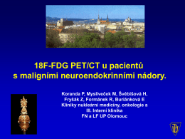18F-FDG PET/CT u pacientů s metastazujícími maligními