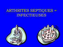 ARTHRITES INFECTIEUSES
