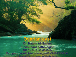 ovarian cyst