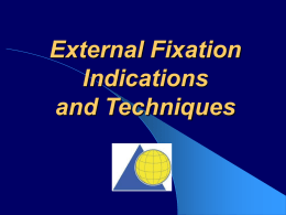 External Fixation Indications and Techniques