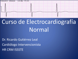 ECG Normal - Carpe Diem – Cogito ergo sum