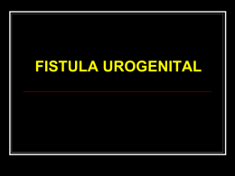 2.3.4.6 fistula urogenital