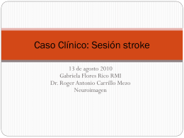 Caso Clínico: Sesión stroke
