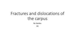 Fractures and dislocations of the carpus