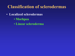 scleroderma