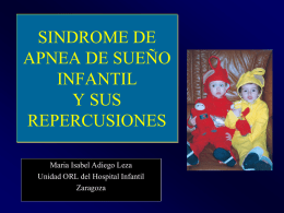 SINDROME DE APNEA DE SUEÑO INFANTIL Y SUS