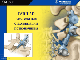 Редукционные щипцы TSRH-3D