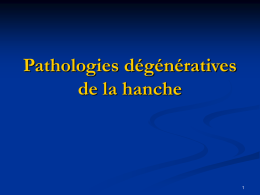 Pathologies dégénératives de la hanche