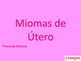 Miomas de Útero.