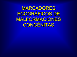 Clase 3.- MARCADORES ECOGRAFICOS DE MALFORMACIONES