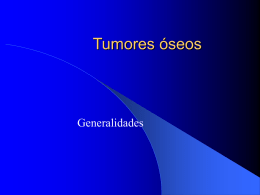 Tumor de células gigantes (osteoclastoma)
