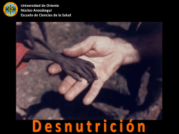 Pesentación Desnutrición I