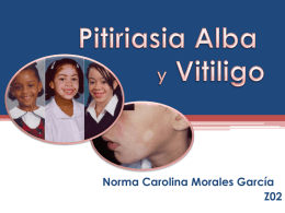 Pitiriasis Alba y vitiligo