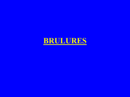 BRULURES