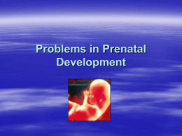 Problems in Prenatal Development Power Point