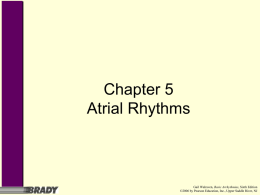 Chapter 5 Atrial Rhythms