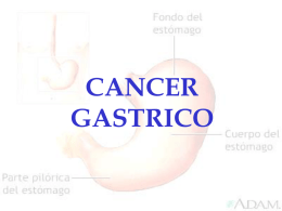 Cancer Gastrico. modificado