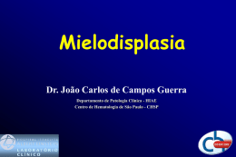 50_Mielodisplasia - Centro de hematologia de São Paulo